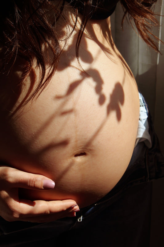 Do Stretch Mark Creams and Oils Actually Work? Love Boo
